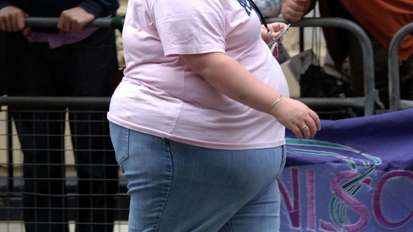 obesity