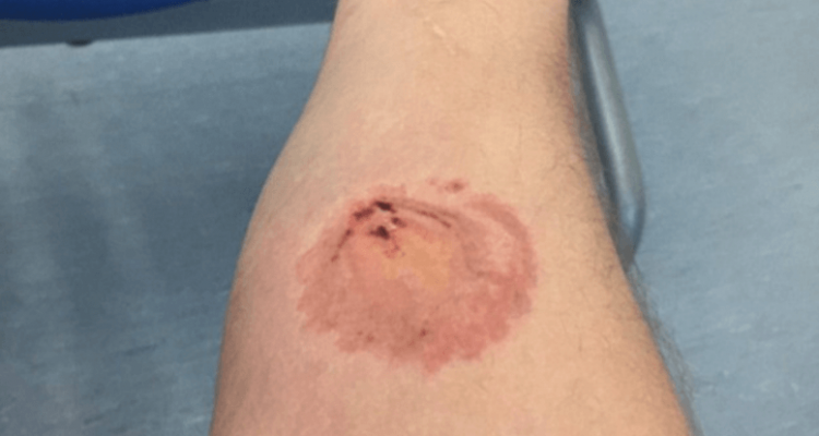 Man Bitten By Violent Passenger ON British Airways Flight | Secret Flying