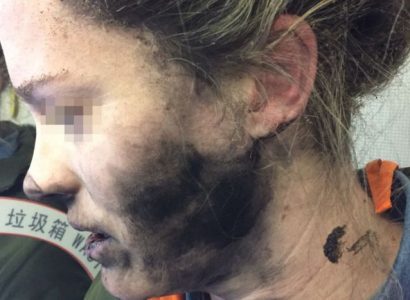 Headphones explode on woman’s face during flight | Secret Flying