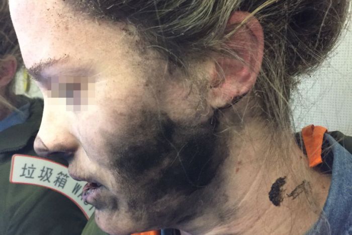 Headphones explode on woman’s face during flight