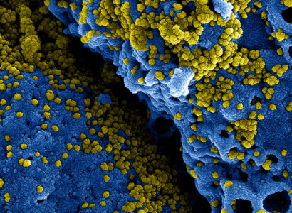 Airport screenings for the Chinese coronavirus increase around the world | Secret Flying