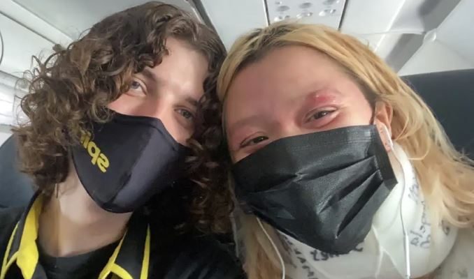 Woman tells Spirit Airlines staff to educate themselves after her eczema was mistaken for monkeypox | Secret Flying Woman tells Spirit Airlines staff to educate themselves after her eczema was mistaken for monkeypox | Secret Flying