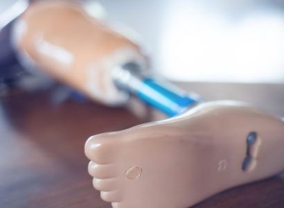Allegiant Airlines blasted for losing prosthetic leg for twelve days ruining passenger’s vacation | Secret Flying
