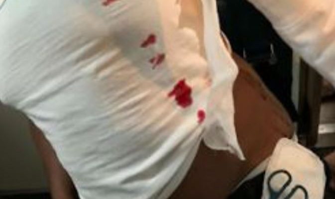 British Airways passenger is STABBED on flight to St Lucia | Secret Flying