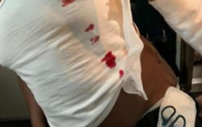 British Airways passenger is STABBED on flight to St Lucia