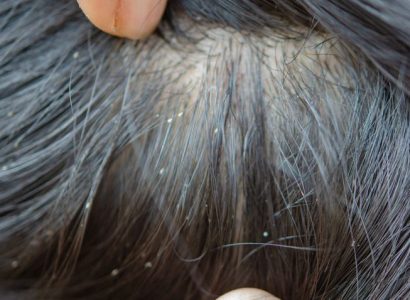 American Airlines flight diverted after passengers spot lice in woman’s hair | Secret Flying
